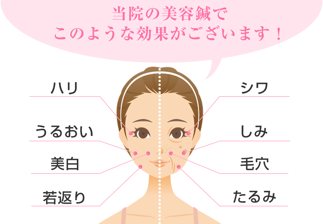 美容針の効果について