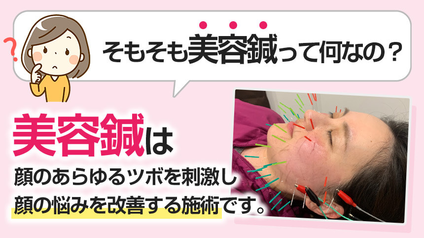 そもそも美容鍼って何なの?
