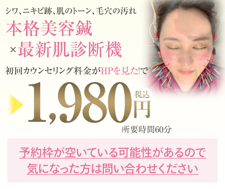 美容鍼オファー