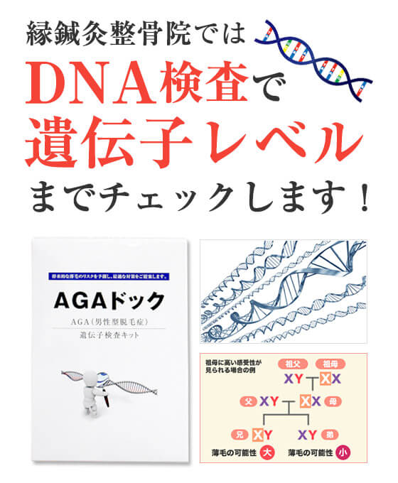 DNA検査
