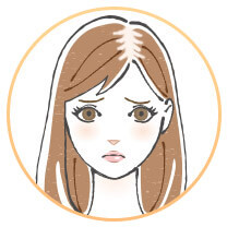 女子男性型脱毛症