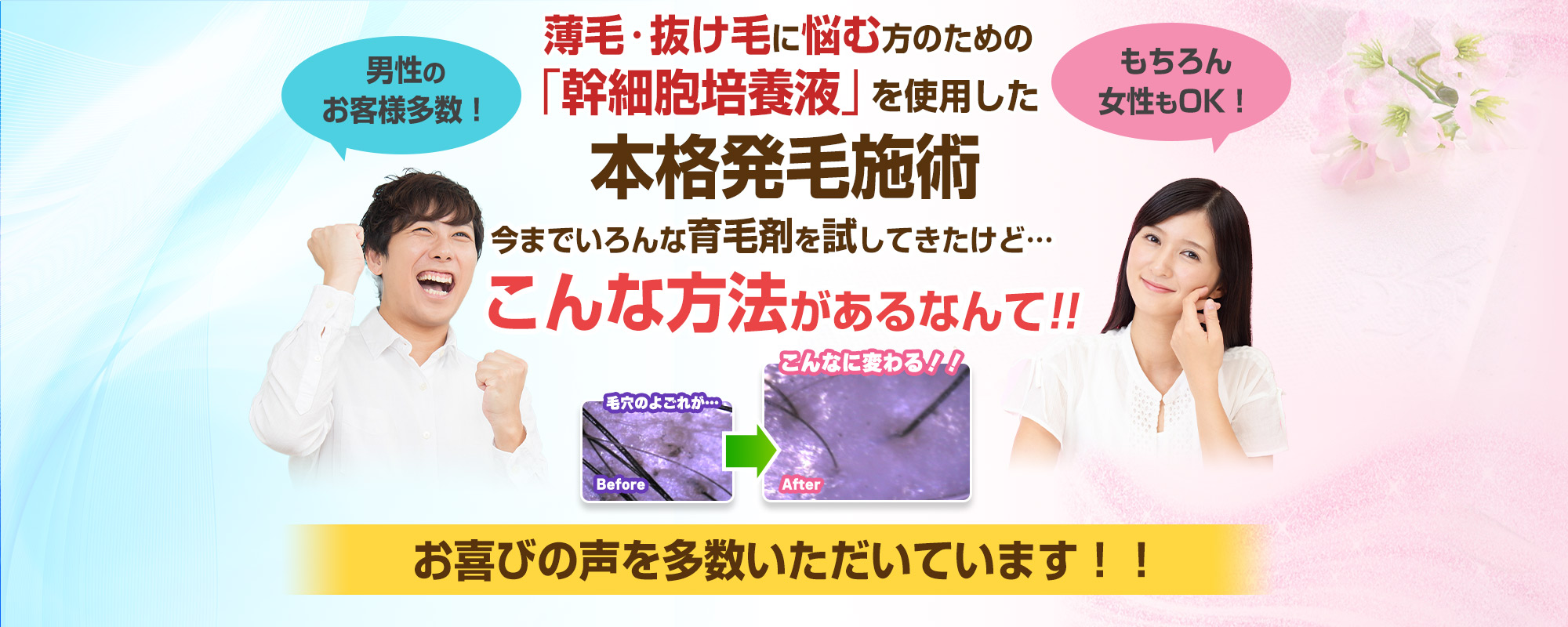本格発毛施術