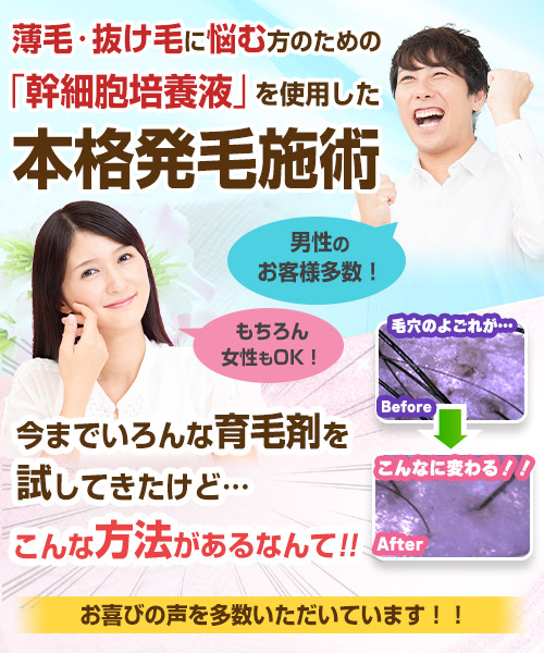本格発毛施術