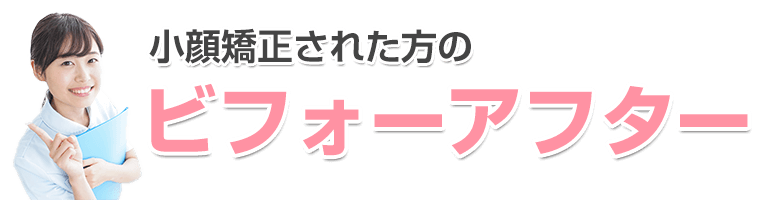 ビフォーアフター