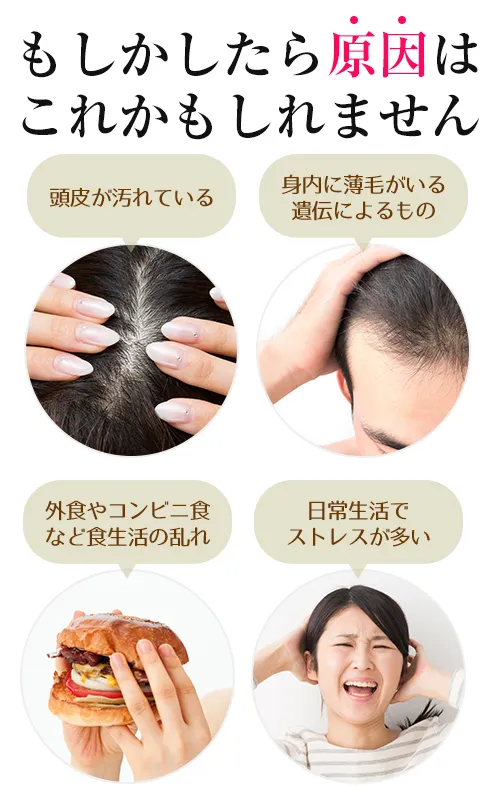 薄毛の原因